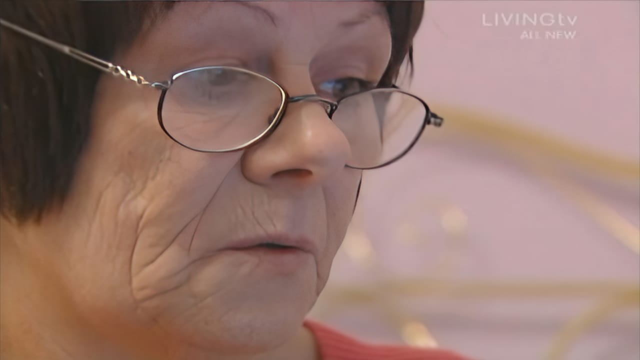 Before Picture - Extreme Makeover UK TV - Maureen - Hair Loss