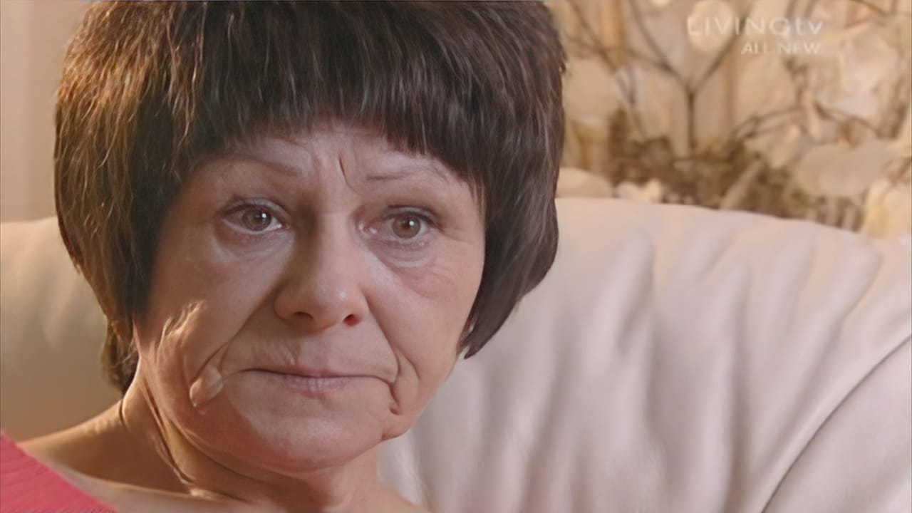 Before Picture - Extreme Makeover UK TV - Maureen - Hair Loss