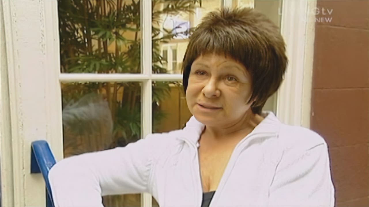 Before Picture - Extreme Makeover UK TV - Maureen - Hair Loss