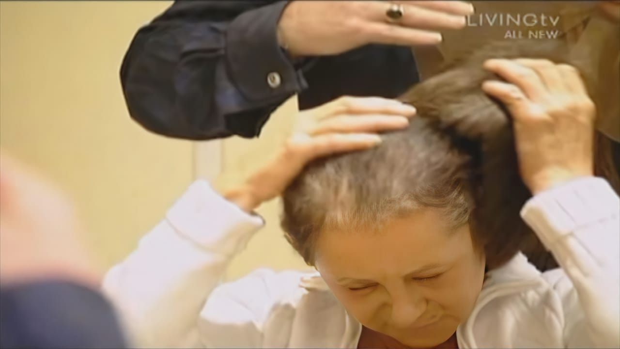 Before Picture - Extreme Makeover UK TV - Maureen - Hair Loss