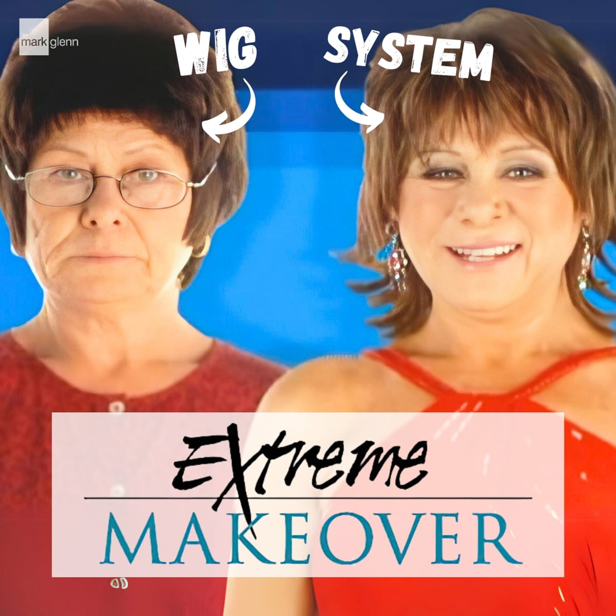 HL101-M - Extreme Makeover UK - Maureen - Hair Loss - Before & After