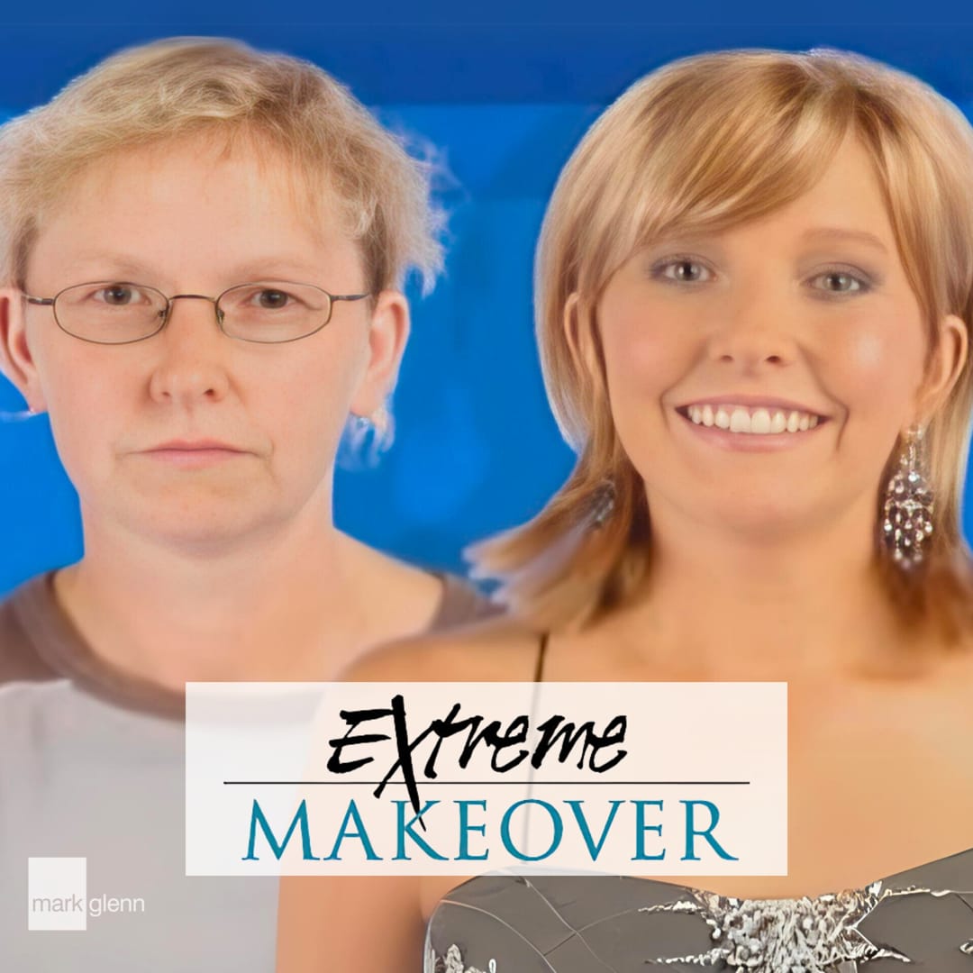 HL102-M - Extreme Makeover UK TV - Kim - Hair Loss Before and After