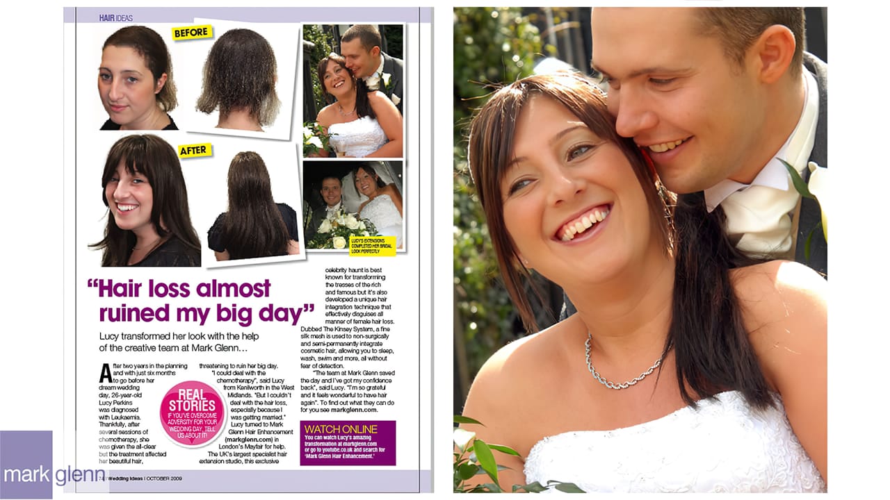 HL103-M - Leukaemia Hair Loss Restored for Wedding - Kinsey System, London