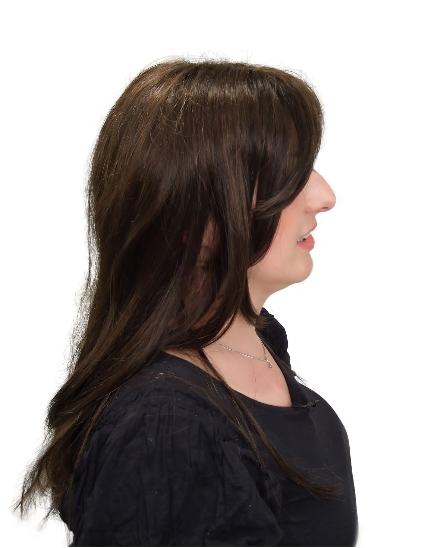 After Picture - Chemotherapy Hair Loss Turnaround