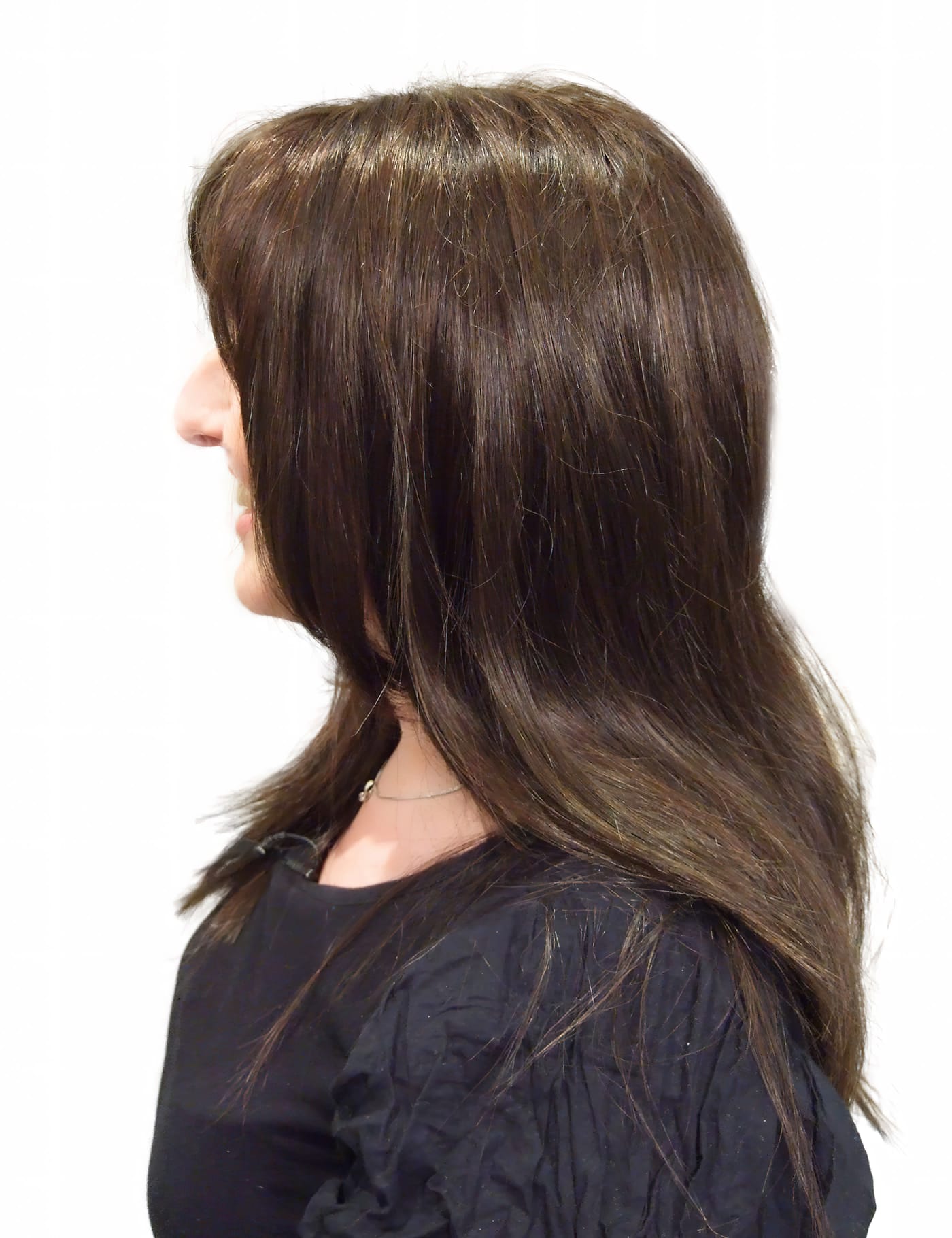 After Picture - Leukaemia Hair Loss Restored for Wedding