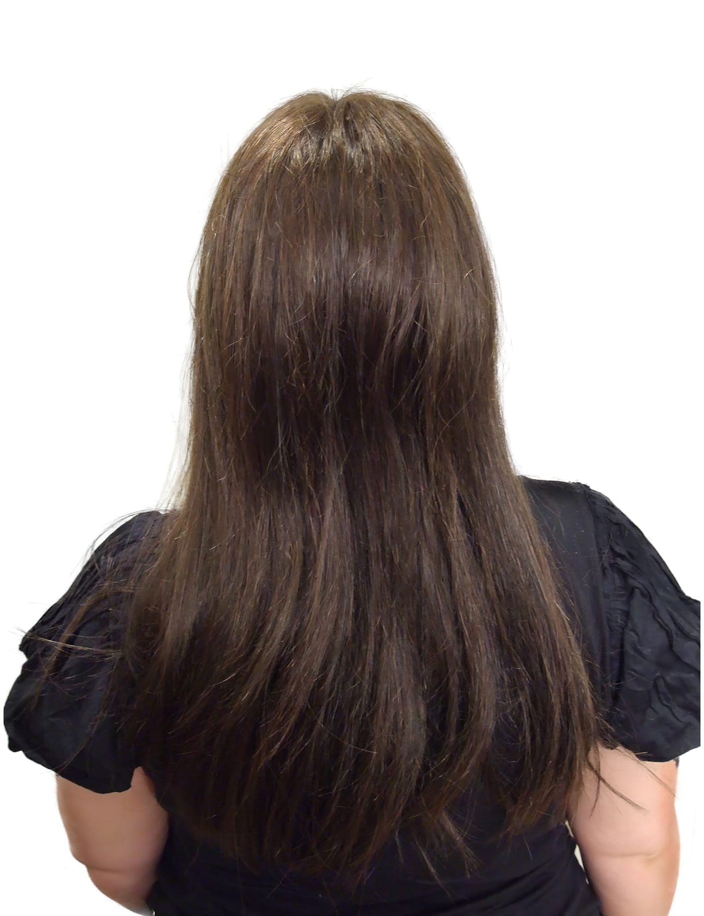 After Picture - Leukaemia Hair Loss Restored for Wedding