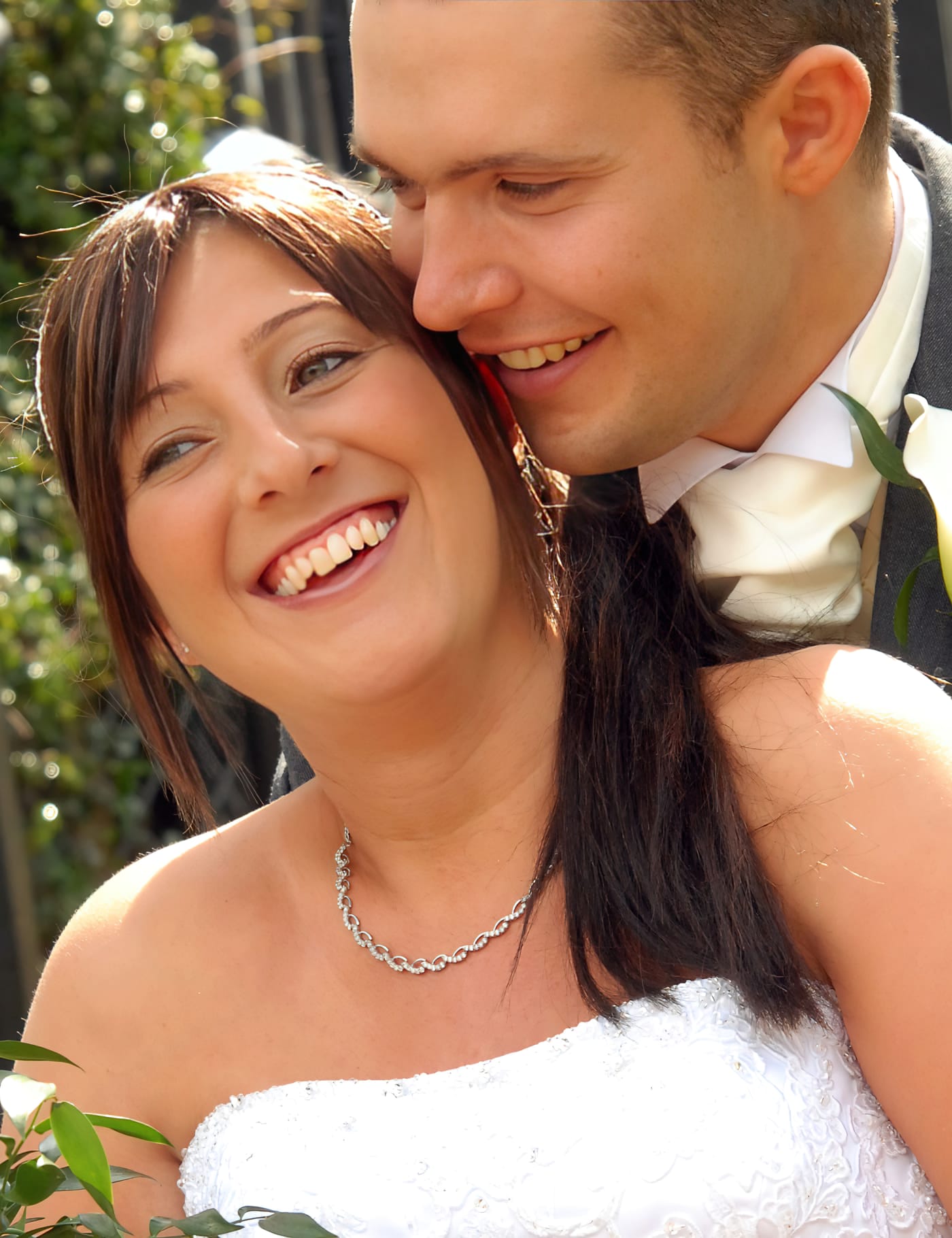 After Picture - Leukaemia Hair Loss Restored for Wedding