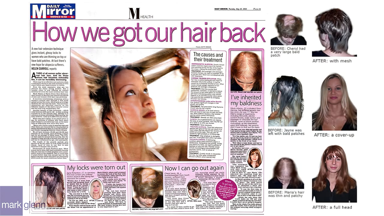 HL109-M - Three Types of Female Hair Loss Cosmetically Fixed - Mark Glenn, London