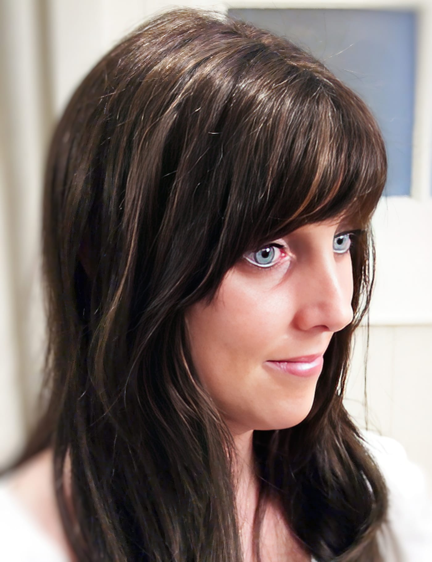 After Picture - Radiotherapy & Surgery Hair Loss - No More Wigs