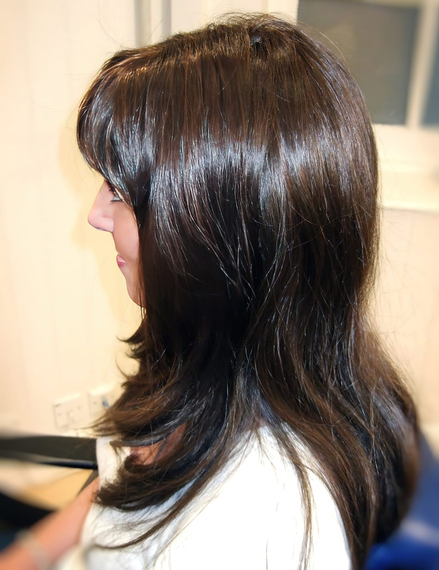After Picture - Radiotherapy & Surgery Hair Loss - No More Wigs
