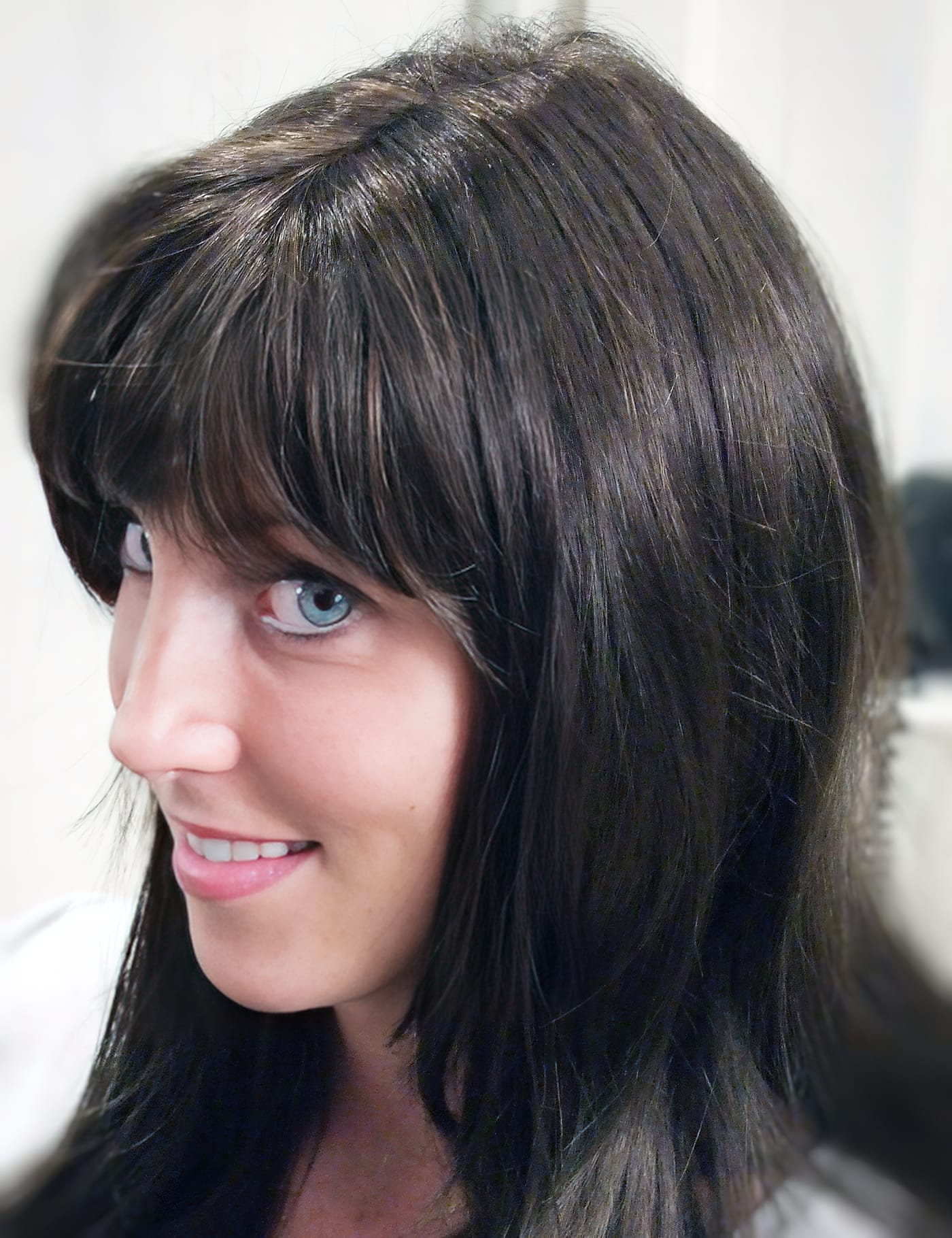 After Picture - Radiotherapy & Surgery Hair Loss - No More Wigs