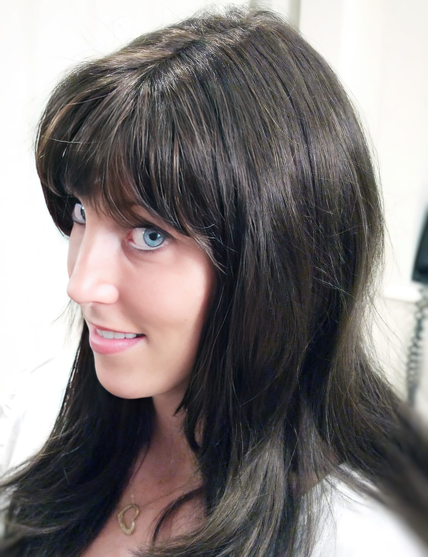 After Picture - Radiotherapy & Surgery Hair Loss - No More Wigs