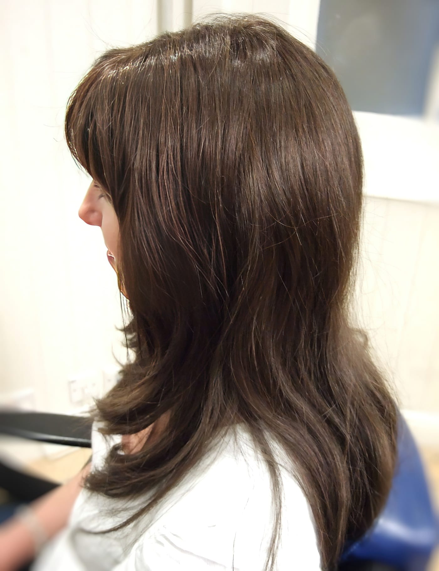 After Picture - Radiotherapy & Surgery Hair Loss - No More Wigs