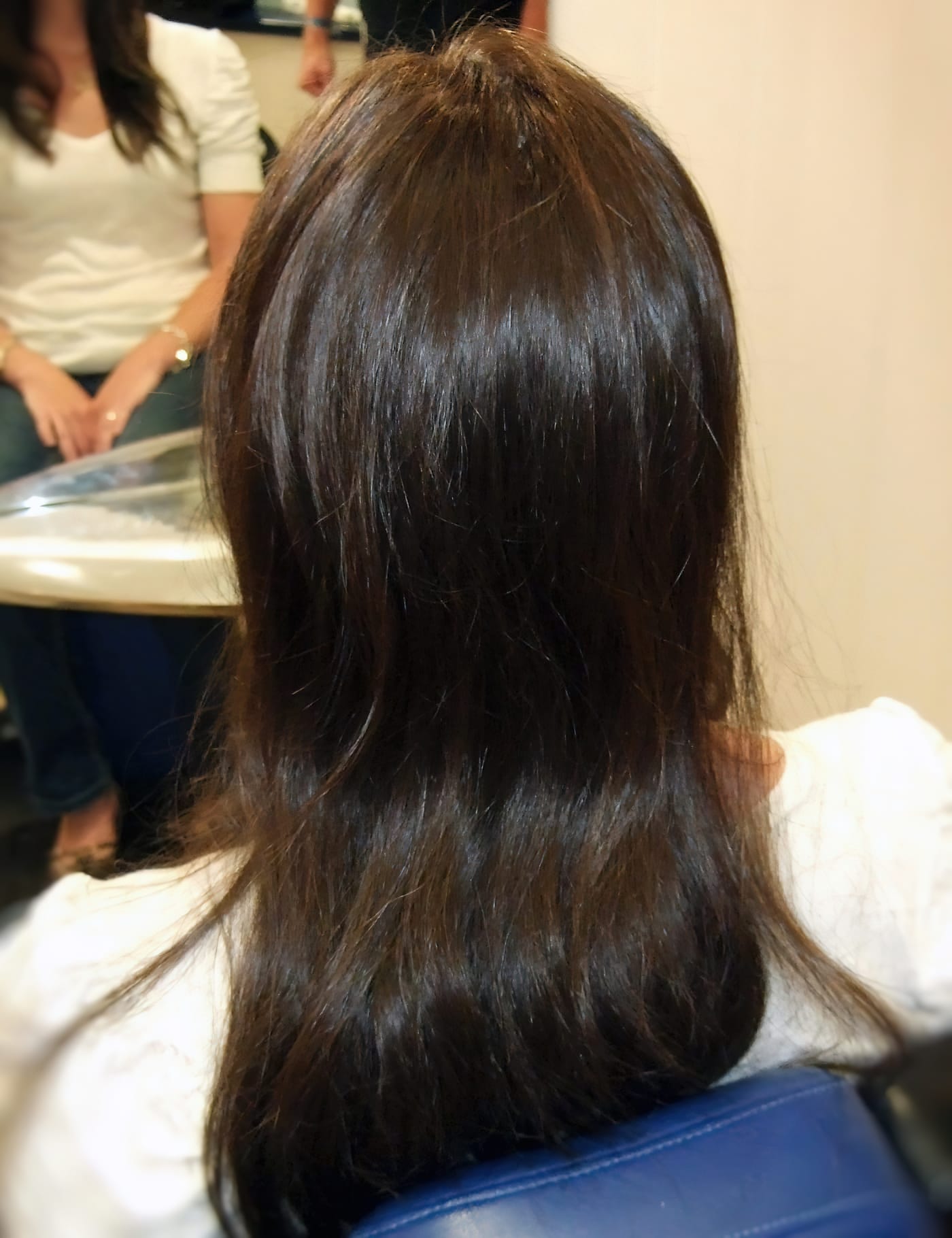 After Picture - Radiotherapy & Surgery Hair Loss - No More Wigs