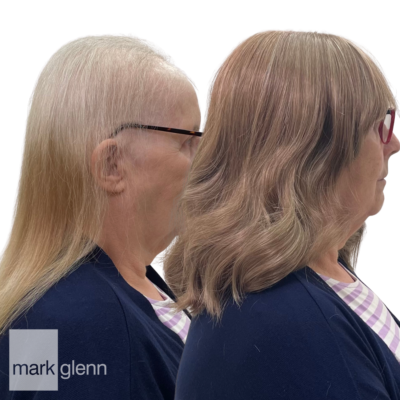 HL115 - Androgenetic Alopecia or Female Pattern Hair Loss Solution - Mark Glenn, London