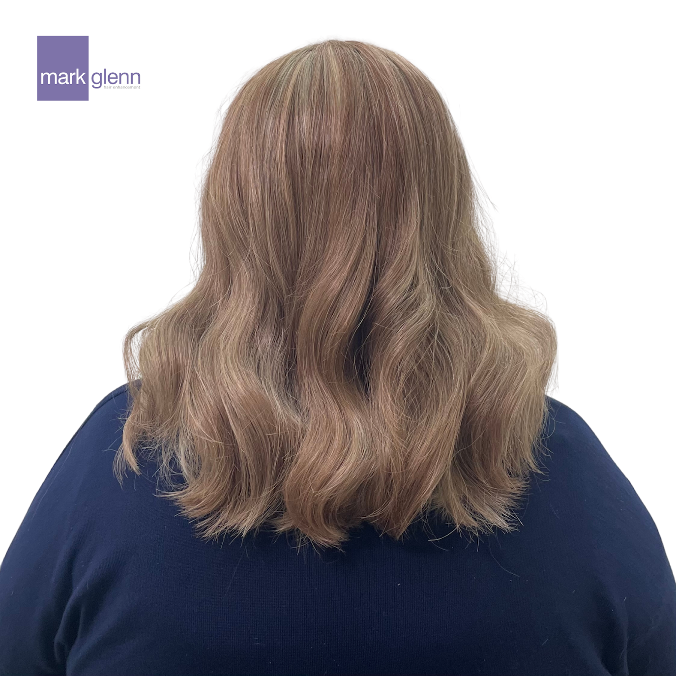 After Picture - Androgenetic Alopecia or Female Pattern Hair Loss Transformation
