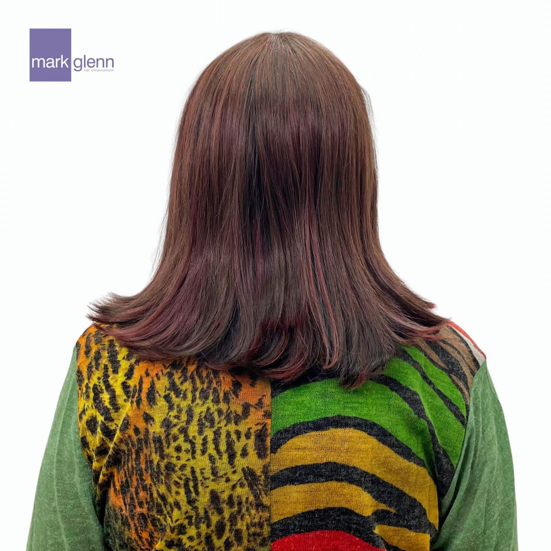 After Picture - Cancer Chemotherapy Permanent Hair Loss Transformation