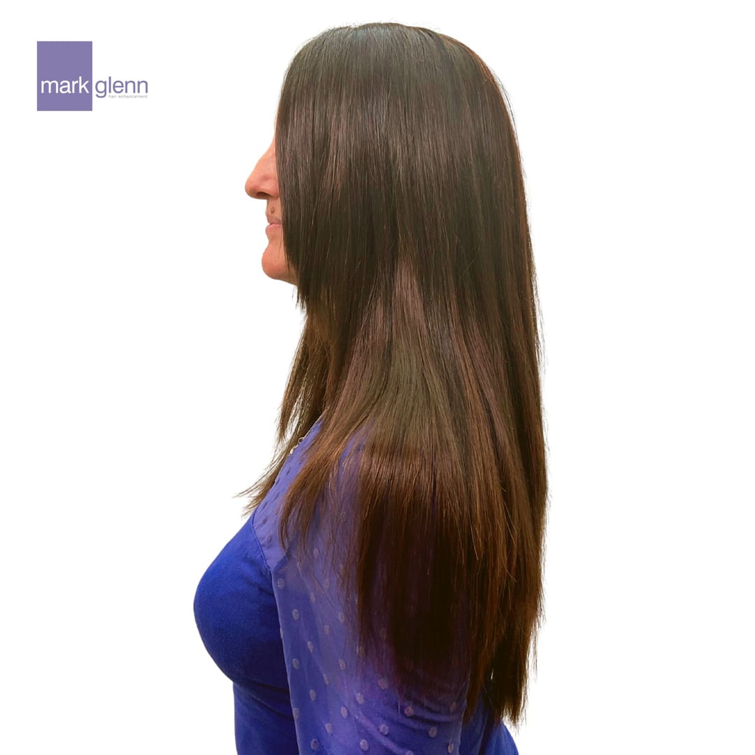 After Picture - Semi-Permanent Superior Wig-Alternative for Alopecia Hair Loss