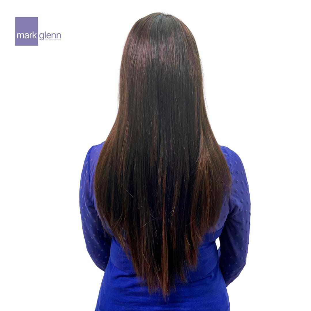 After Picture - Semi-Permanent Superior Wig-Alternative for Alopecia Hair Loss