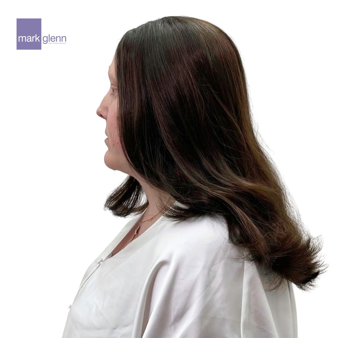 After Picture - Alopecia Areata Miracle Makeover