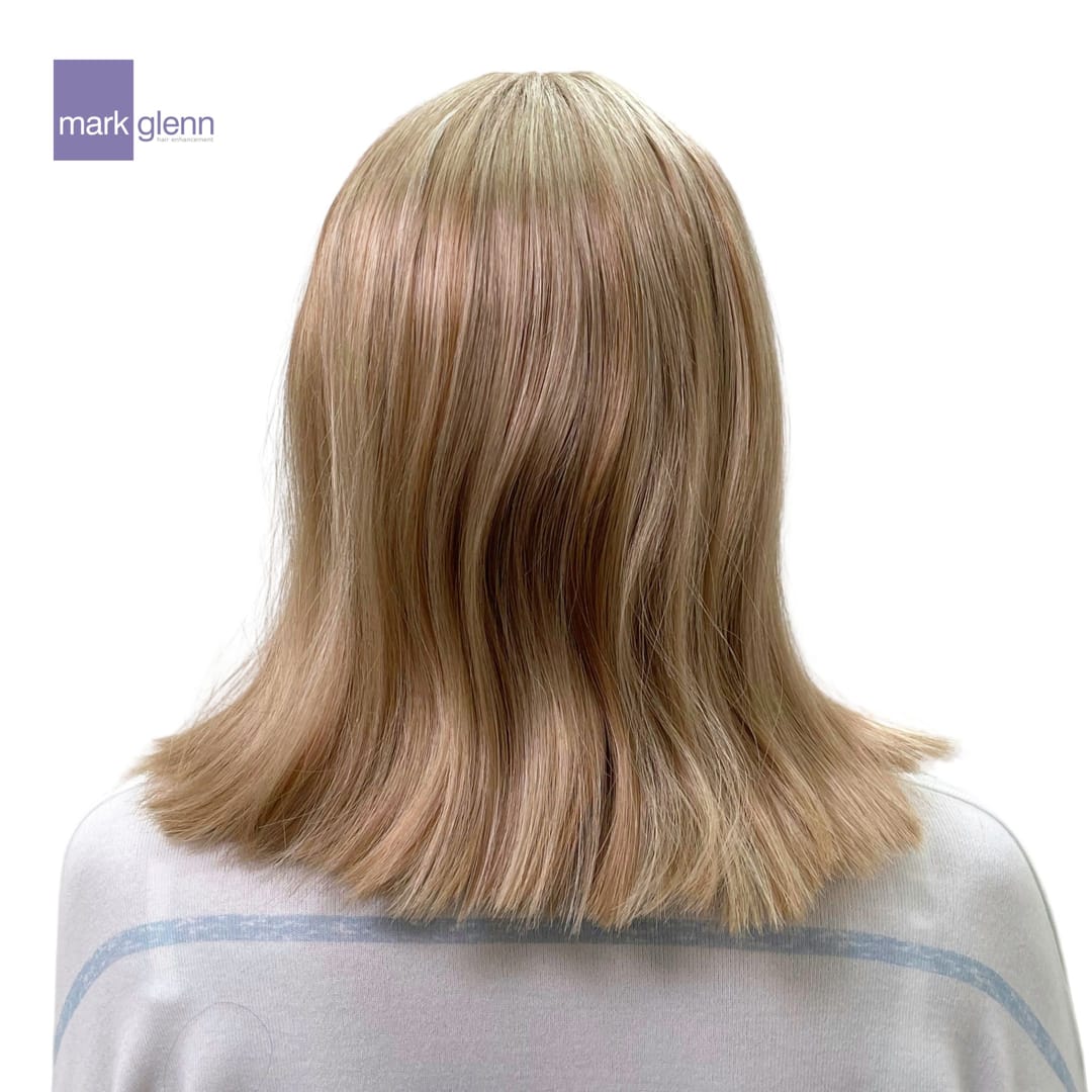 After Picture - Female Pattern Hair Loss / Androgenetic Alopecia Magical Makeover