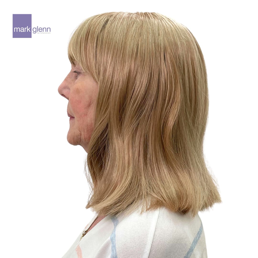 After Picture - Female Pattern Hair Loss / Androgenetic Alopecia Magical Makeover