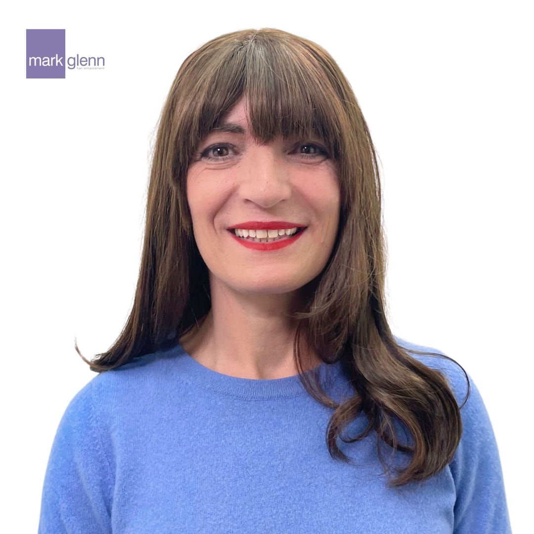 After Picture - Superior Wig Alternative for Female Hair Loss