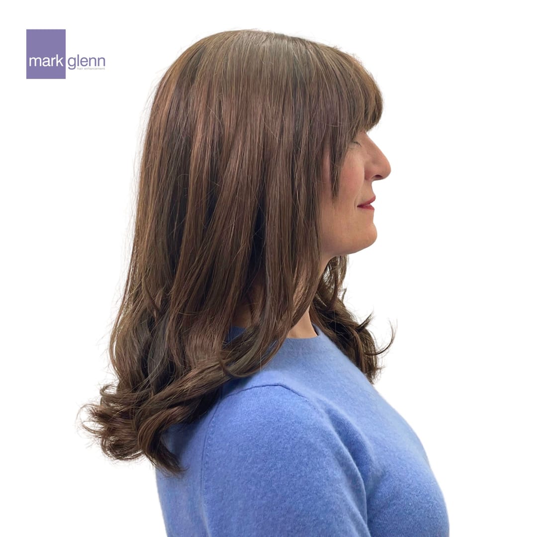 After Picture - Superior Wig Alternative for Female Hair Loss