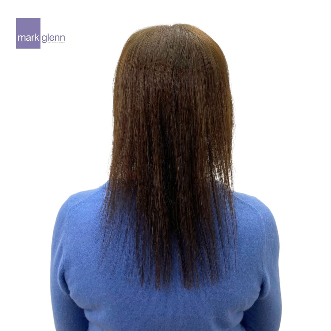 Before Picture - Superior Wig Alternative for Female Hair Loss