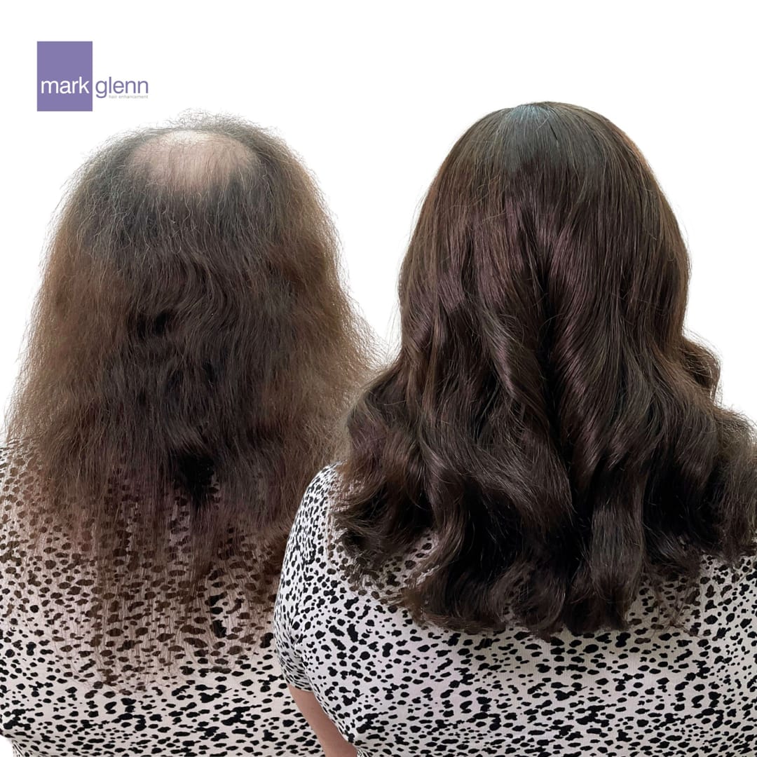 HL121 - Women's' Hair Loss Semi-Permanent Wig Alternative