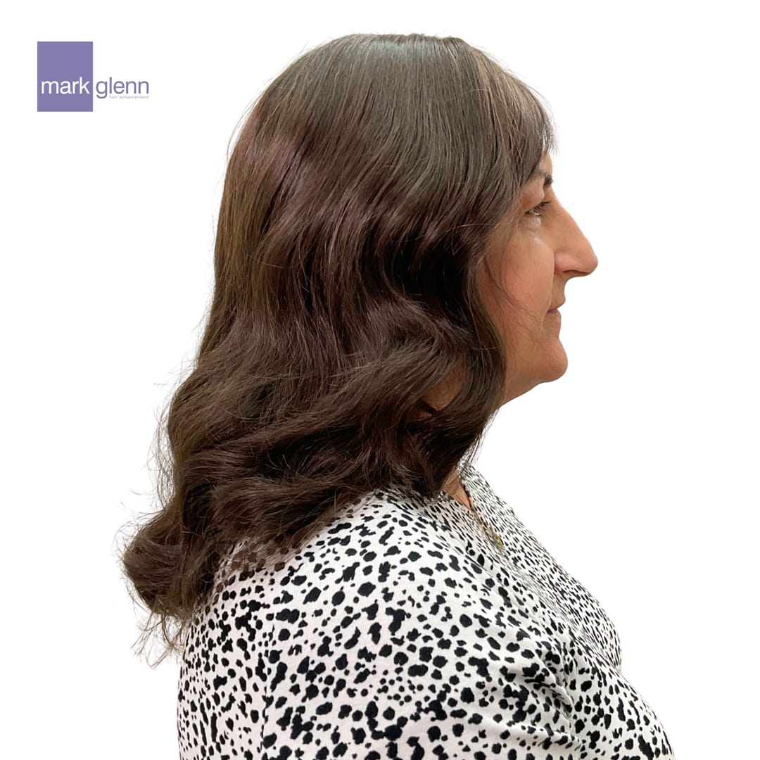After Picture - Women's' Hair Loss Semi-Permanent Wig Alternative
