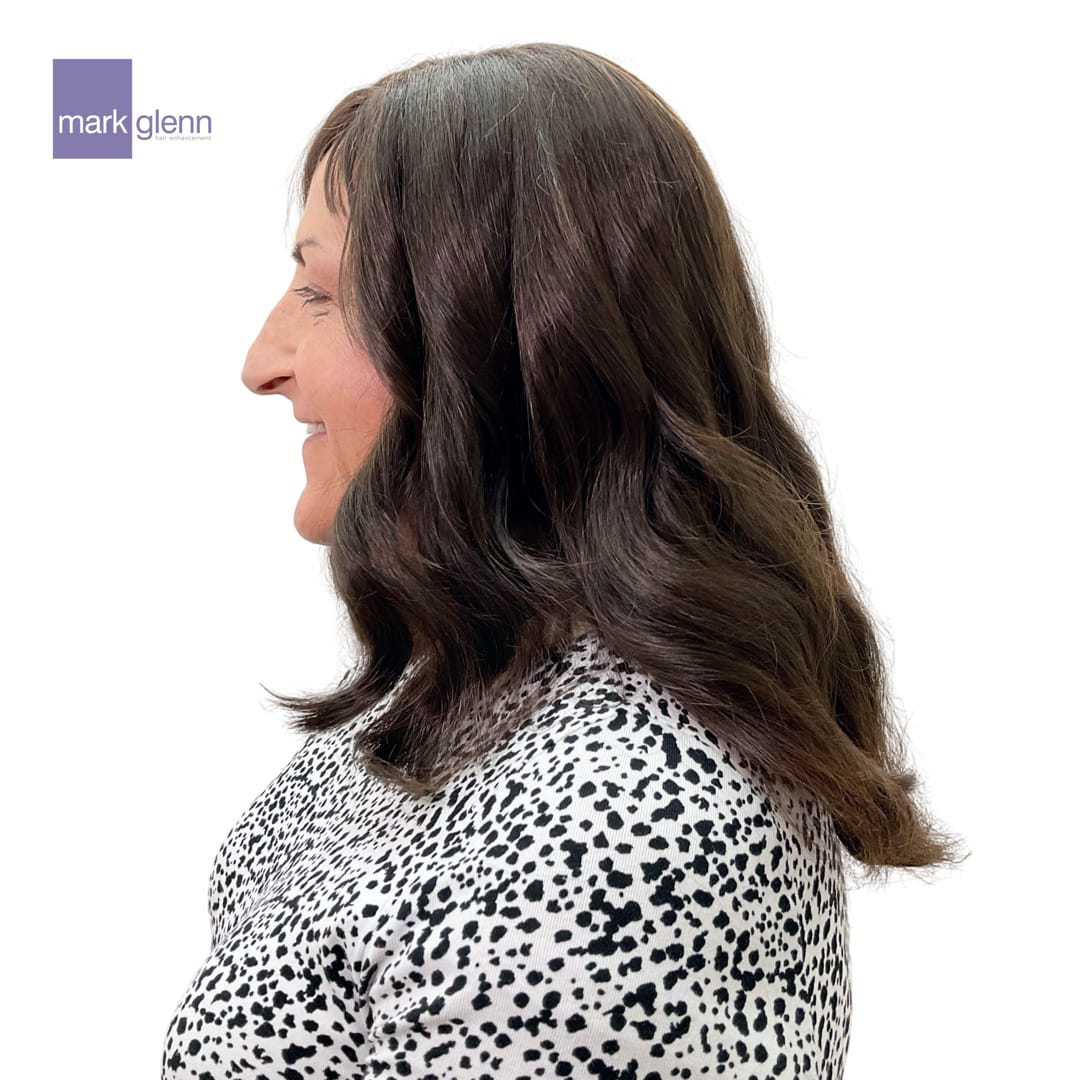 After Picture - Women's' Hair Loss Semi-Permanent Wig Alternative