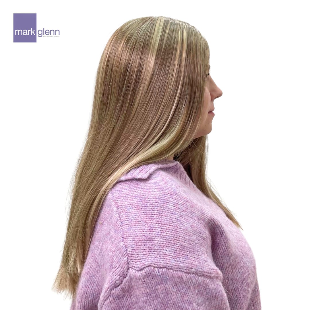 After Picture - Effectively Tackling Trichotillomania with The Kinsey System