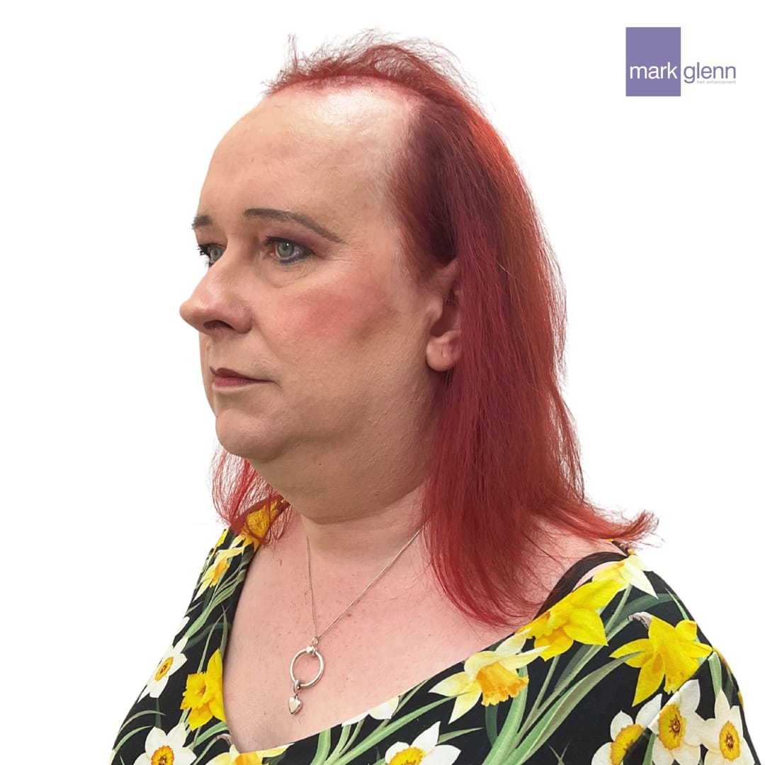 Before Picture - Tantalising Transition in Gorgeous Red - Semi-Permanent Trans Wig Alternative