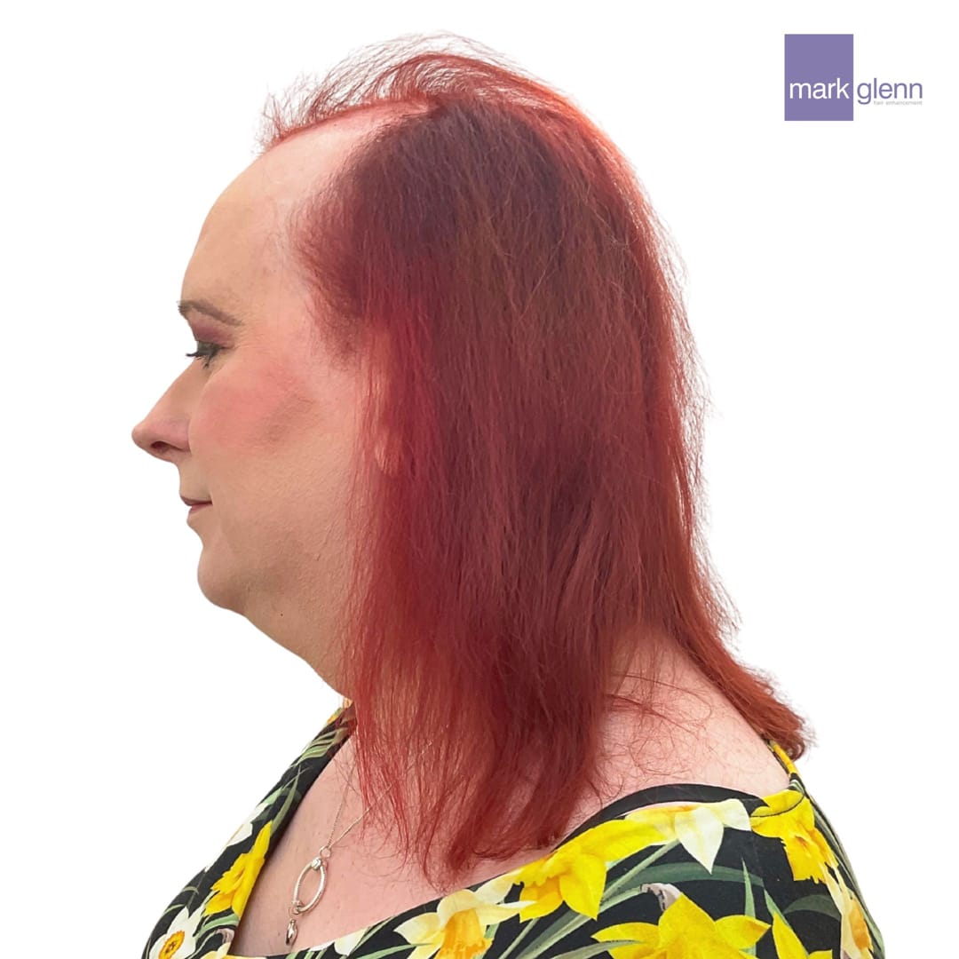 Before Picture - Tantalising Transition in Gorgeous Red - Semi-Permanent Trans Wig Alternative