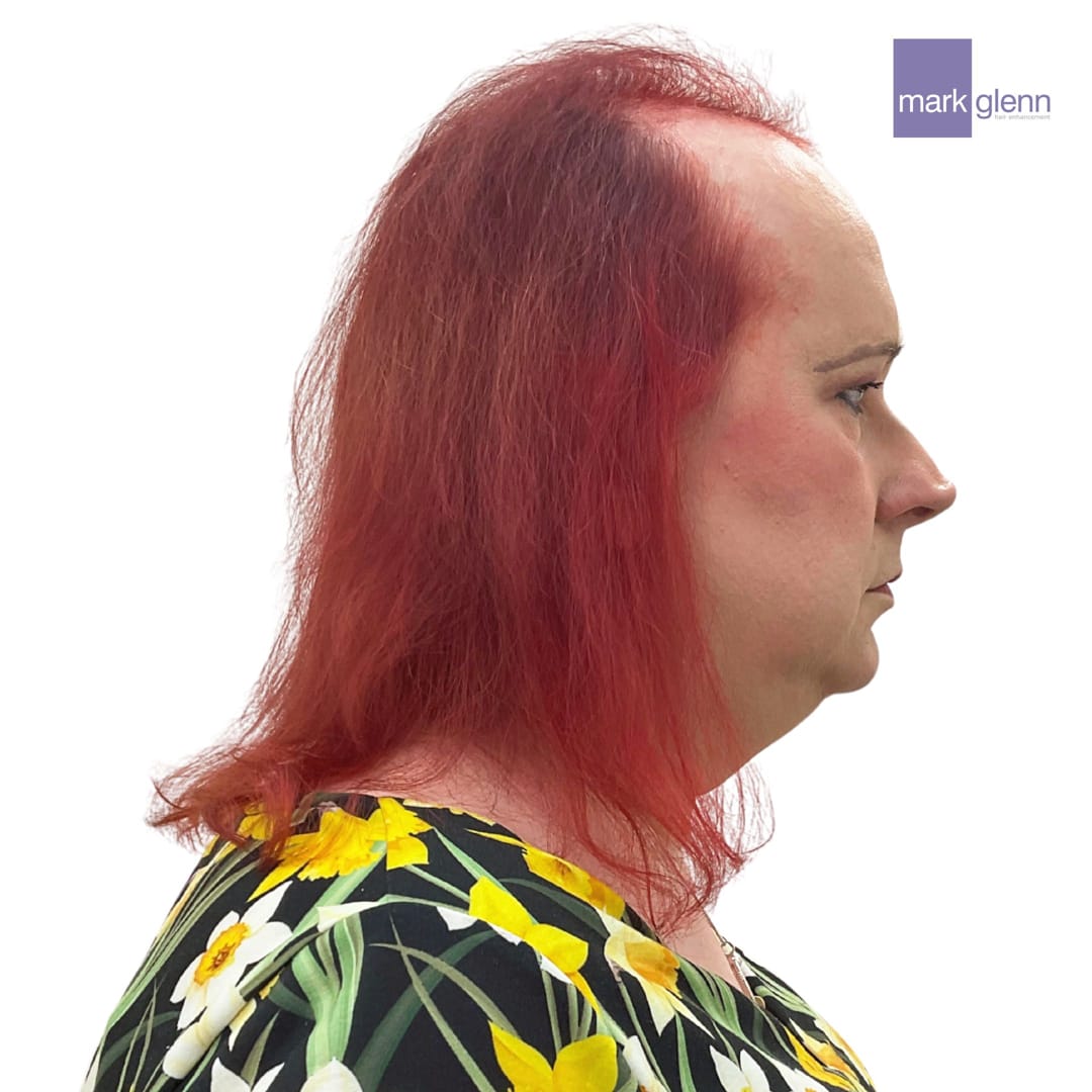 Before Picture - Tantalising Transition in Gorgeous Red - Semi-Permanent Trans Wig Alternative
