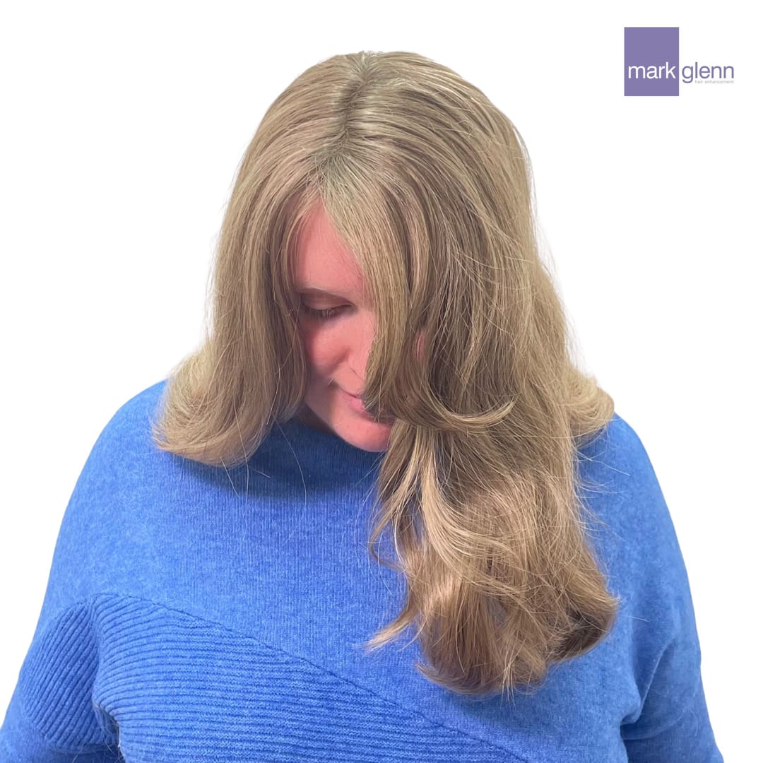 After Picture - Semi-Permanent Wig Alternative for Female Pattern Hair Loss