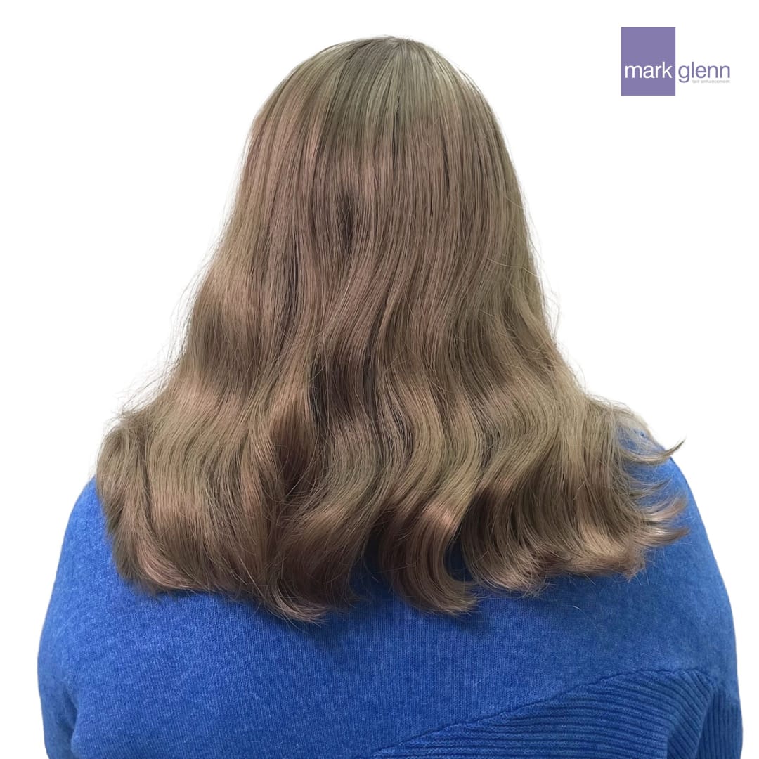 After Picture - Semi-Permanent Wig Alternative for Female Pattern Hair Loss
