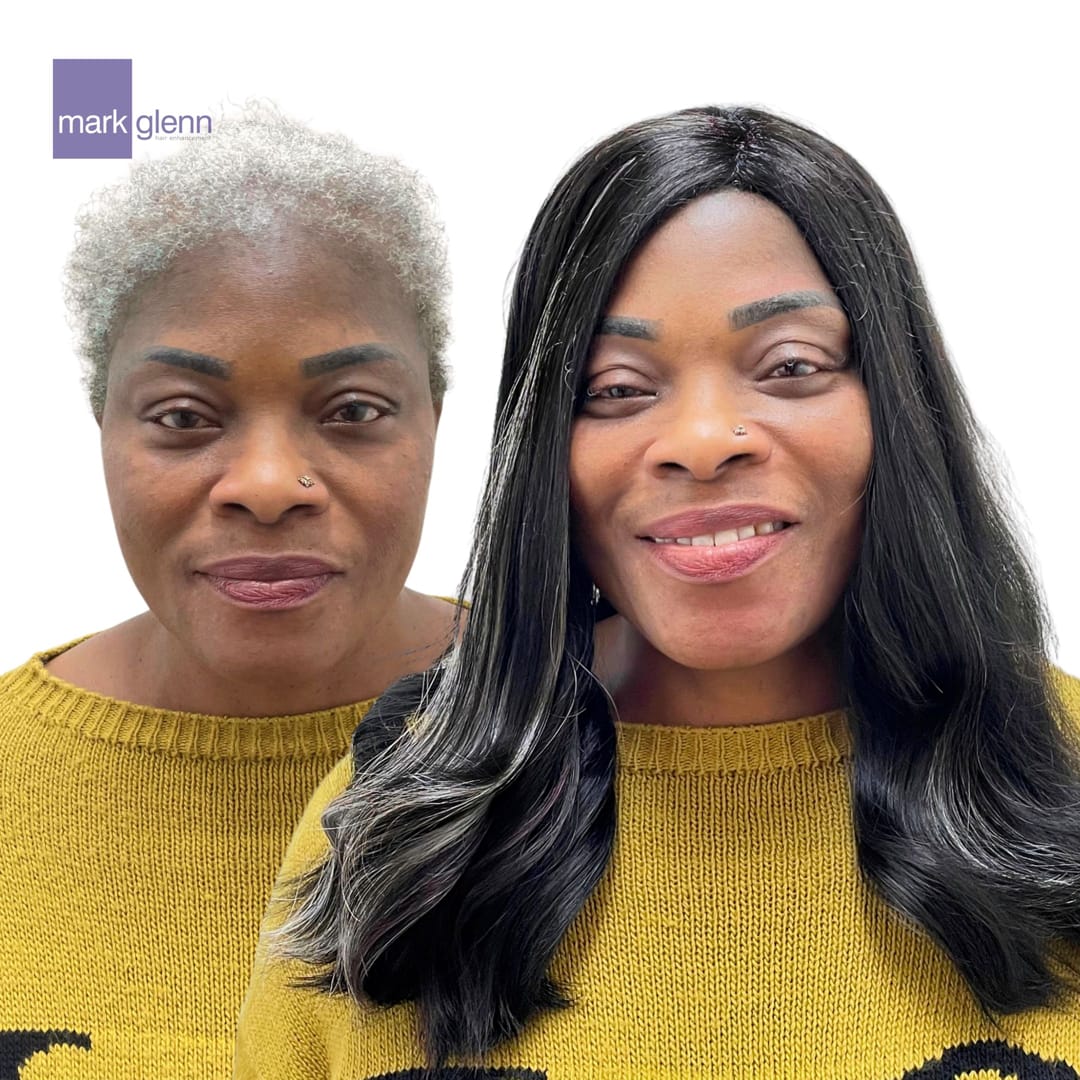 HL125 - Afro Hair Loss Recovery - Semi-Permanent Alternative To Wigs