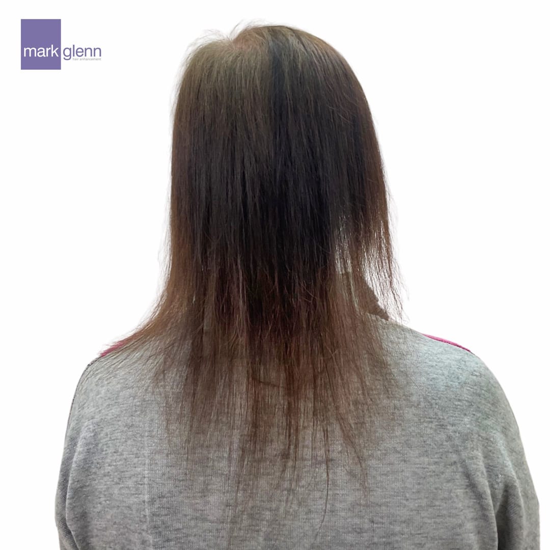 Before Picture - Trichotillomania Transformation With Mark Glenn Hair Extensions