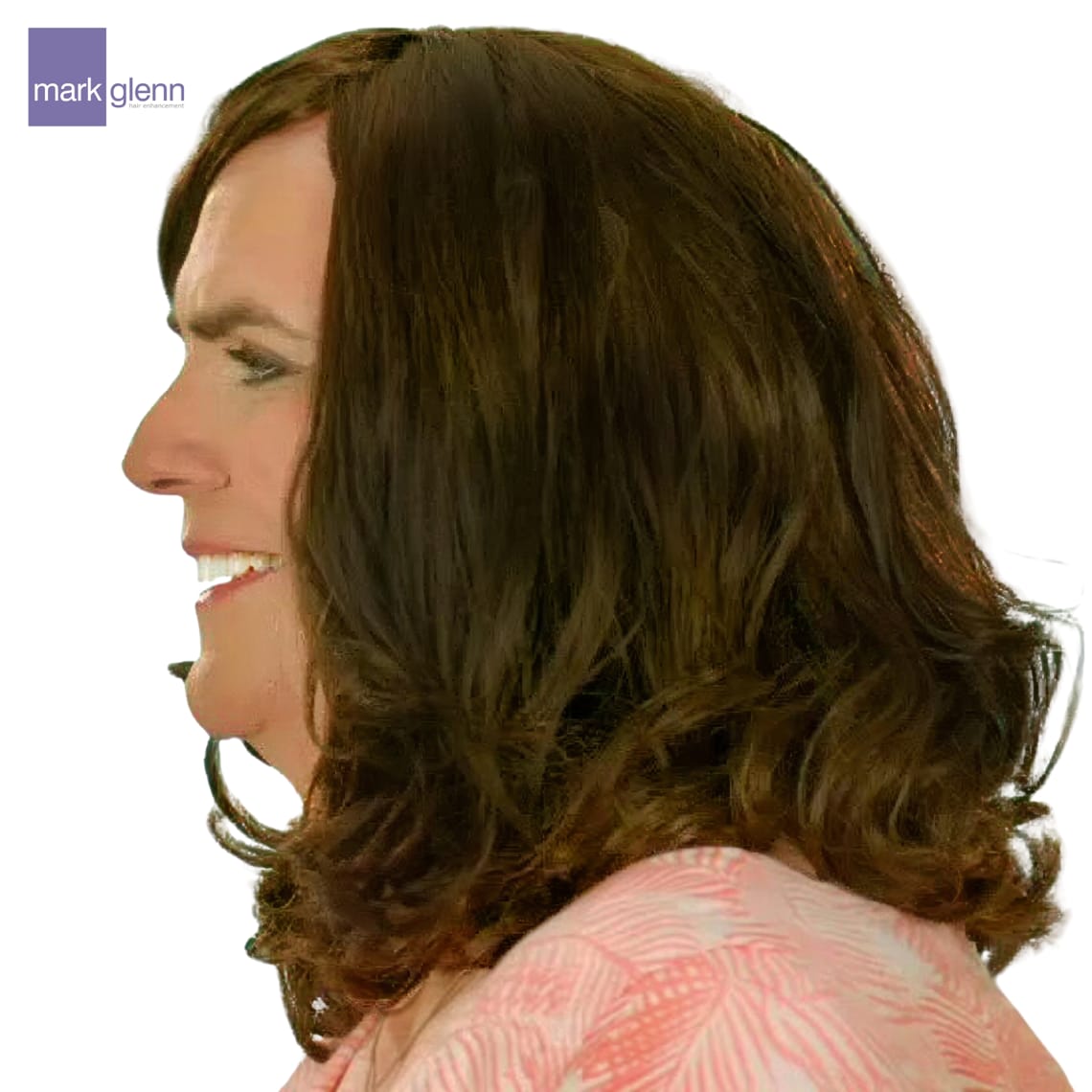 After Picture - 'The Making of Me' - C4 Gender Change Documentary Features The Kinsey System Hair Integration