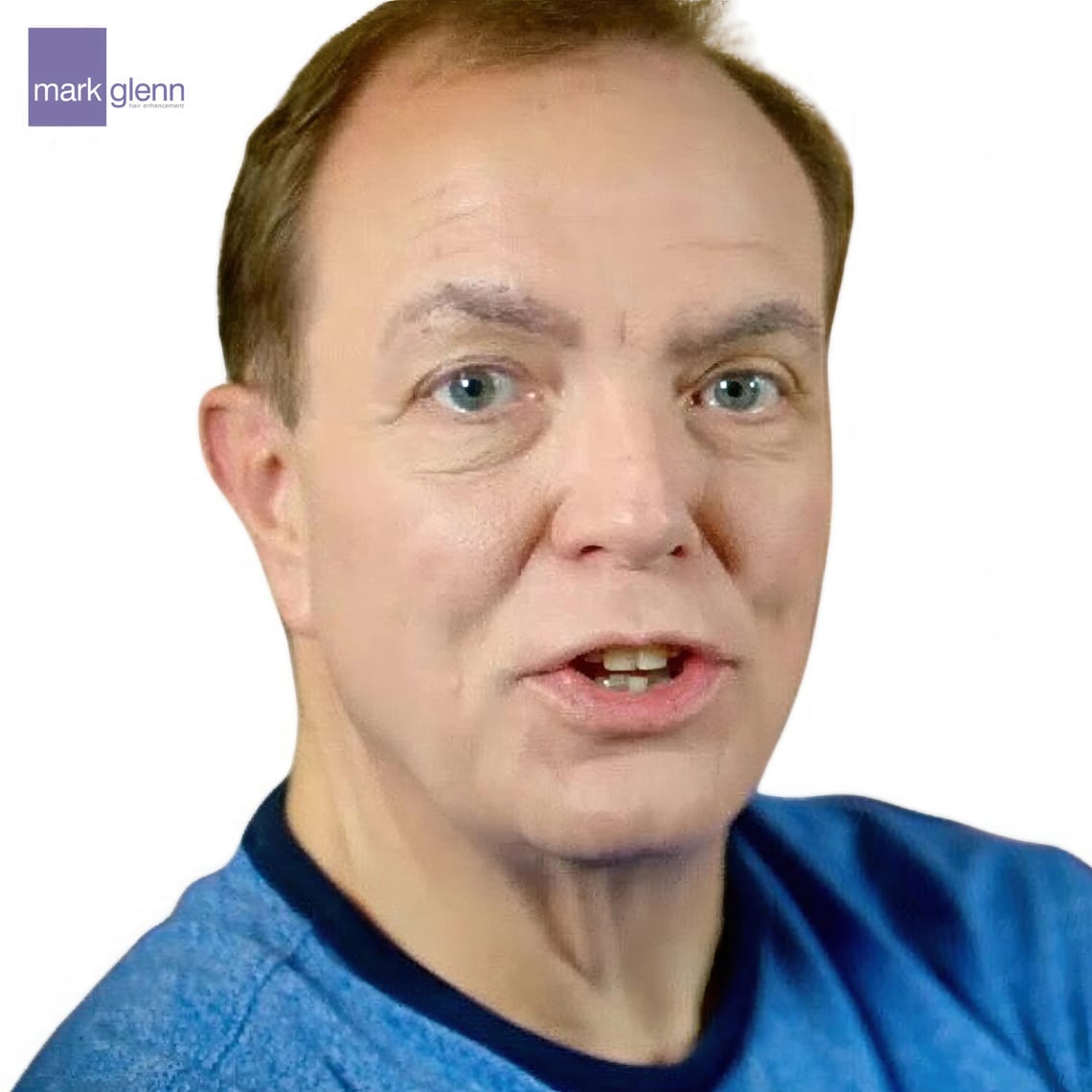 Before Picture - 'The Making of Me' - C4 Gender Change Documentary Features The Kinsey System Hair Integration