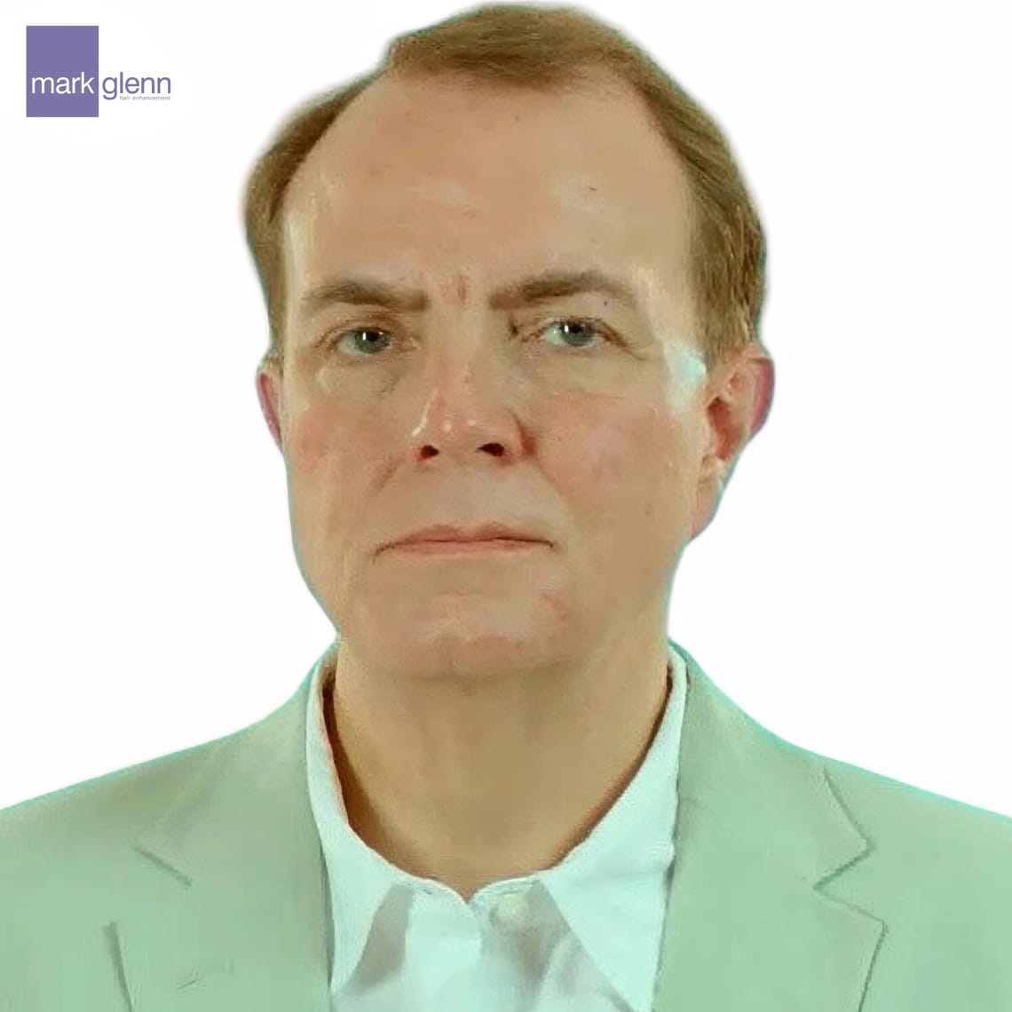 Before Picture - 'The Making of Me' - C4 Gender Change Documentary Features The Kinsey System Hair Integration