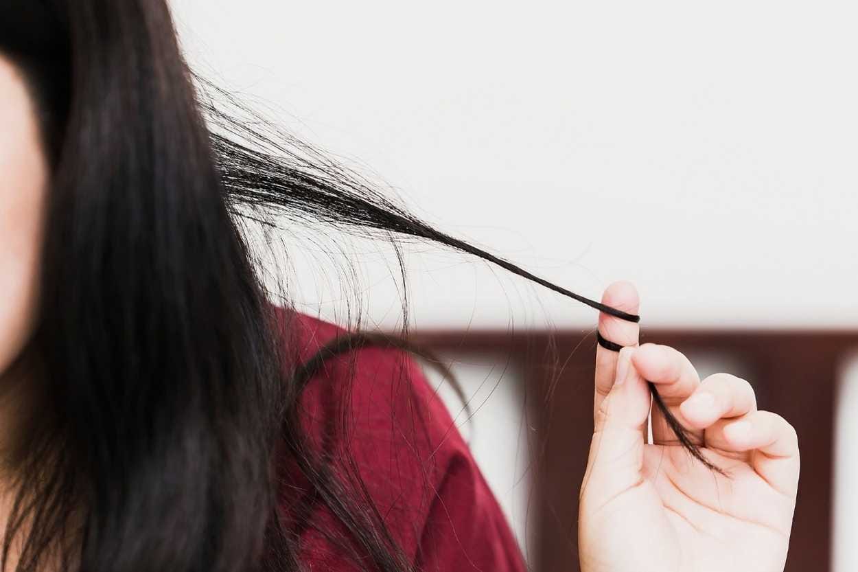 Trichotillomania (compulsive hair pulling)