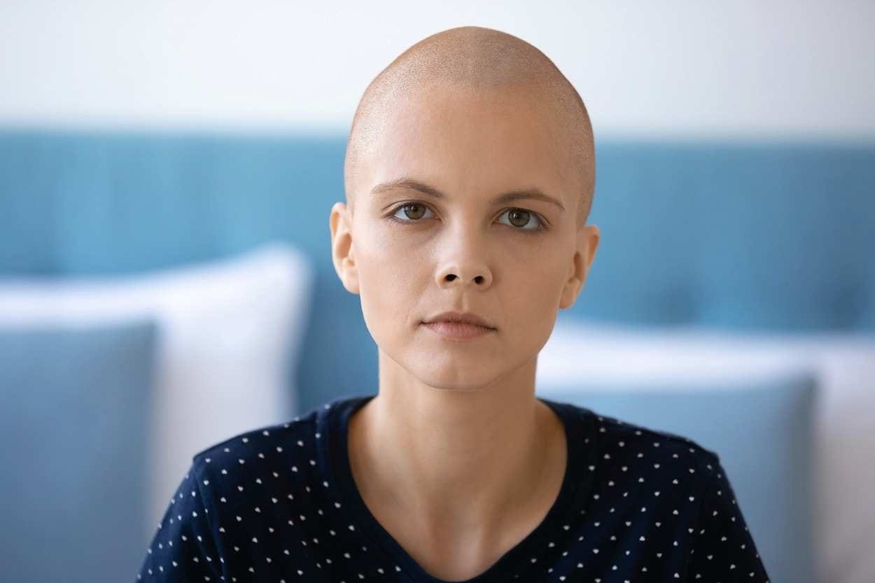 Chemotherapy, Radiotherapy and Cancer Treatments