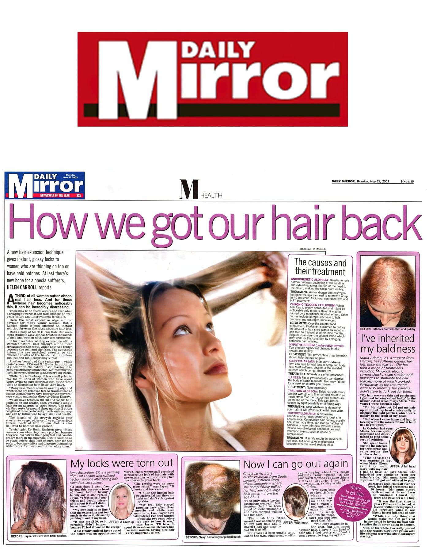 Daily Mirror hails Mark Glenn's female hair loss techniques