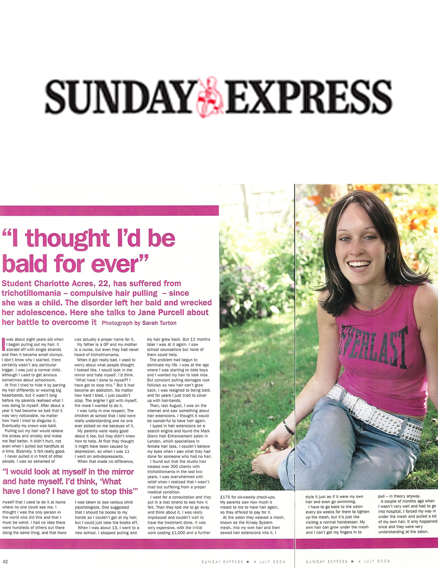 'I thought I'd be bald forever' - Trichotillomania solution from Mark Glenn in The Sunday Express