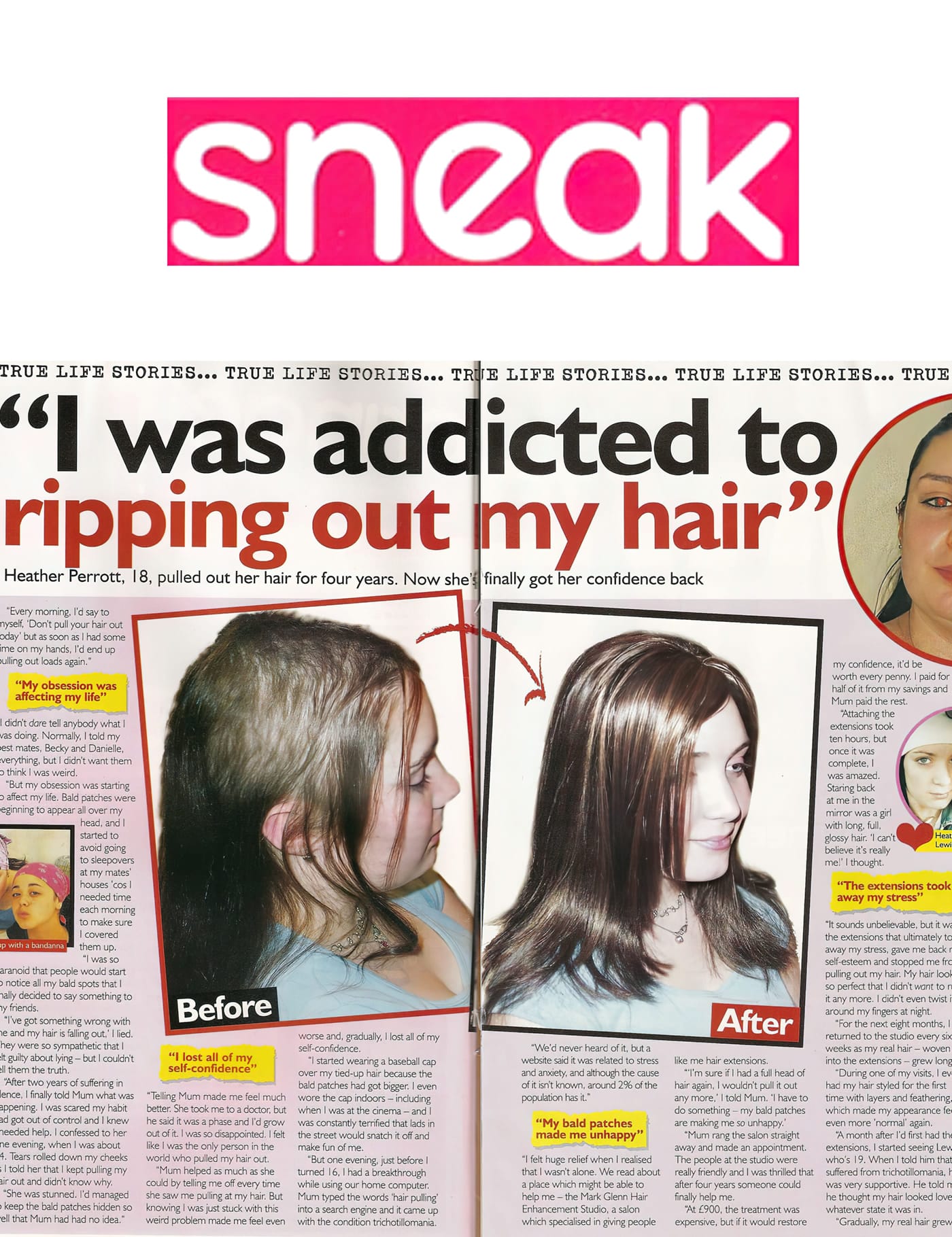 'I was addicted to ripping out my hair' - Mark Glenn's trichotillomania solution: Sneak Magazine