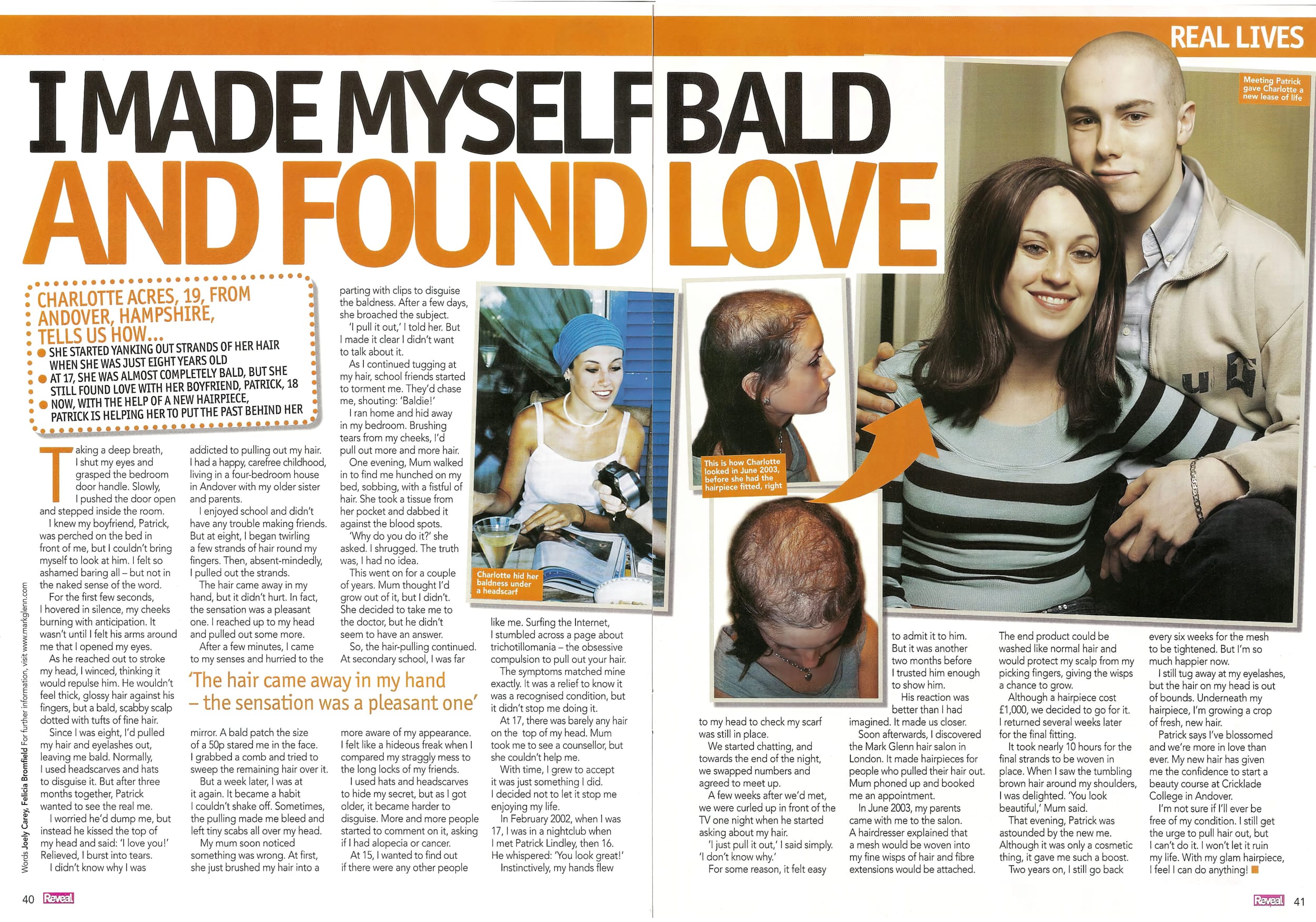 'I made myself bald and found love' - Mark Glenn's Trichotillomania solution: Reveal Magazine