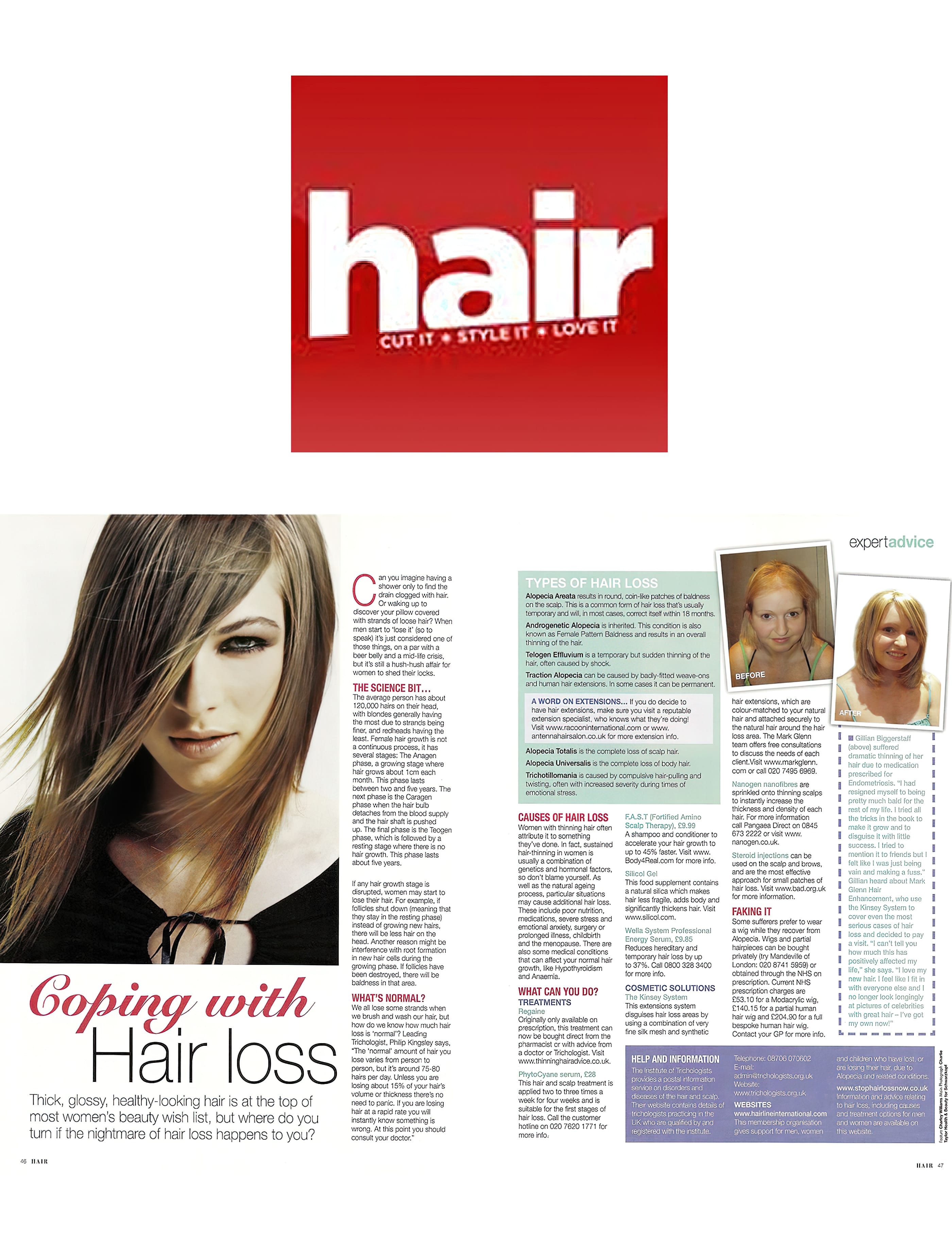 'Coping with hair loss' - Hair Magazine recommends and features MG's Kinsey System